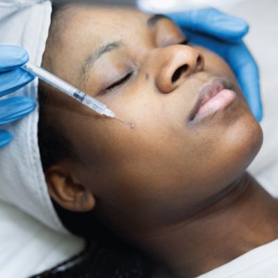 Dermal Fillers